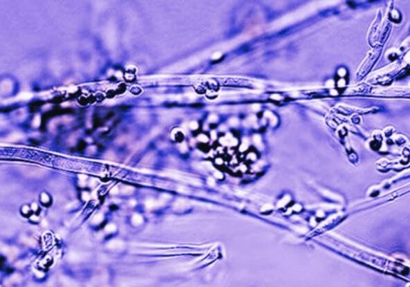 Tiny mold spores growing on a plant surface, emphasizing plant health issues, mold prevention, and natural remedies at The Flower Pot holistic shop.