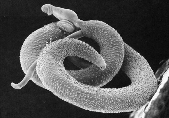 Schistosoma_mansoni2